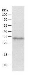 Recombinant Human DNAJB6