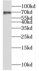 MSN antibody