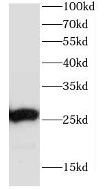 CCDC85B antibody
