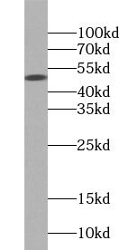 TIPIN antibody