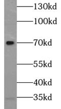 SELENON antibody
