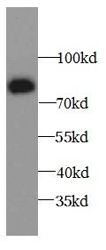 ALOX15B antibody