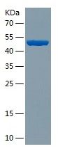 Recombinant Human RPP38