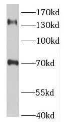 TSC1 antibody