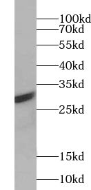 ABT1 antibody