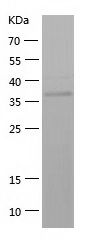 Recombinant Human AKR1C4
