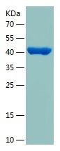 Recombinant Human TOB1