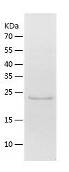 Recombinant Human RAB21