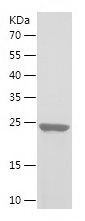 Recombinant Human TAGLN