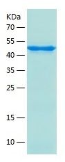 Recombinant Human IYD