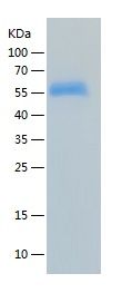 Recombinant Human IL-1R1