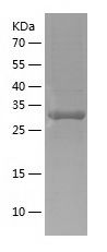 Recombinant Human NSD3