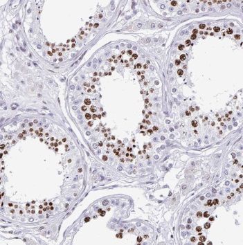 SLC52A3 antibody