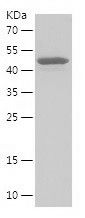 Recombinant Human EIF3B
