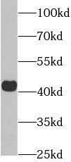 AGER antibody