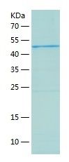 Recombinant Human GALNT14