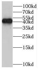 ORM1 antibody