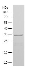 Recombinant Human NES