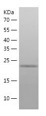 Recombinant Human UBE2R2