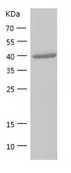 Recombinant Human PSMD4