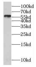 MAGEB18 antibody