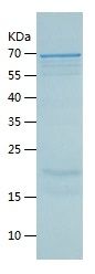 Recombinant Human SQOR
