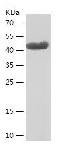 Recombinant Human DDX20