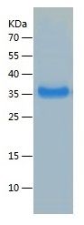 Recombinant Human CXCL11