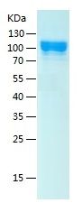 Recombinant Human DCBLD2