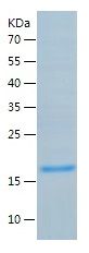 Recombinant Human Asprosin