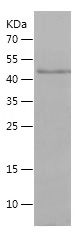 Recombinant Human DLX2