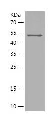 Recombinant Human EYA3