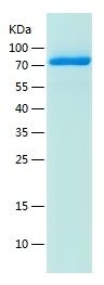 Recombinant Human CD316