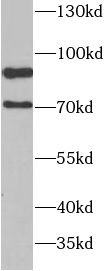 Phospho-p70(S6K) (T389)/p85(S6K) (T412) antibody