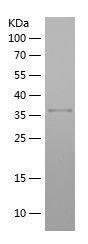 Recombinant Human HNRNPA3
