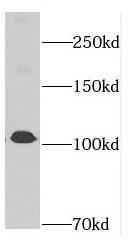 DIS3 antibody