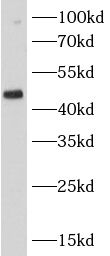 CSK antibody