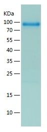 Recombinant Human C1q R1