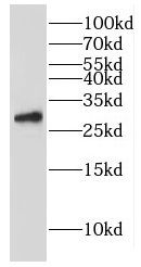 GINS3 antibody