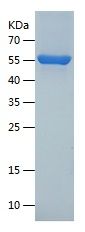 Recombinant Human TXNRD1