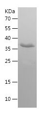 Recombinant Human KLRK1
