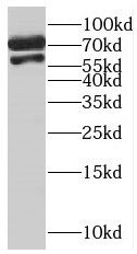 MCMBP antibody