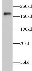 ERCC6L antibody