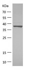 Recombinant Human NAA30