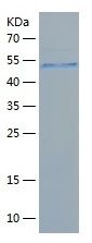 Recombinant Human FLT3