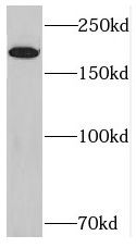 RICTOR antibody