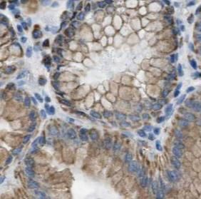 CCKAR-specific antibody