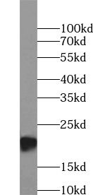 BAX antibody