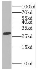 MAGEH1 antibody