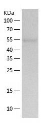 Recombinant Human UGP2
